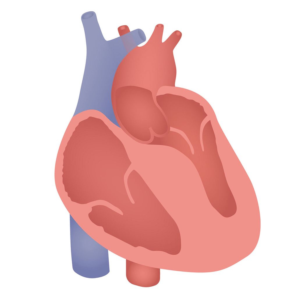 Cardiomyopathie hypertrophique plus fréquente quon ne le croit