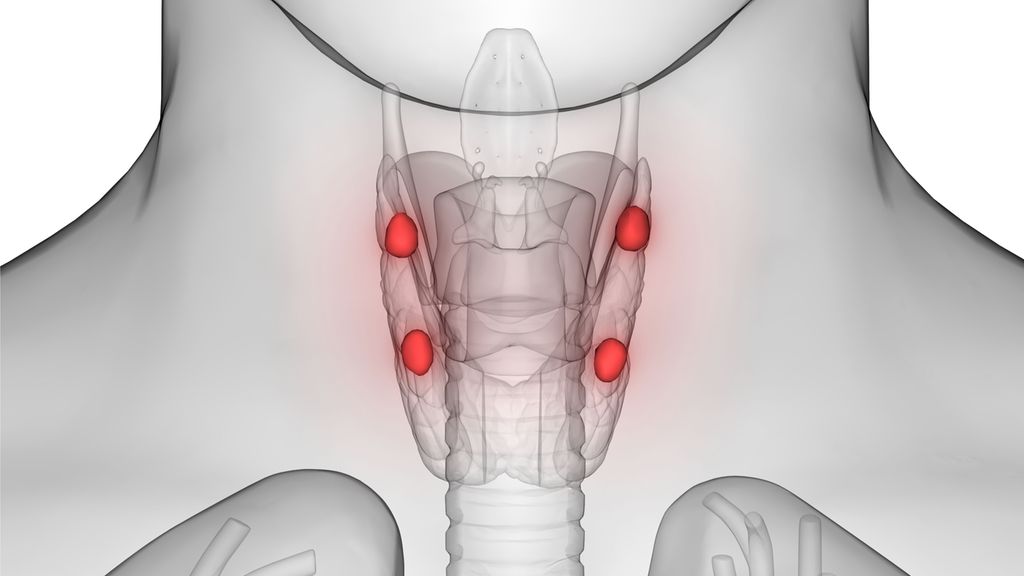 Hypoparathyreoidismus auf den Punkt gebracht