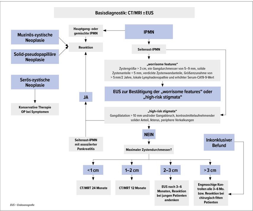 Diagnostischer Algorithmus der International Association of Pancreatology