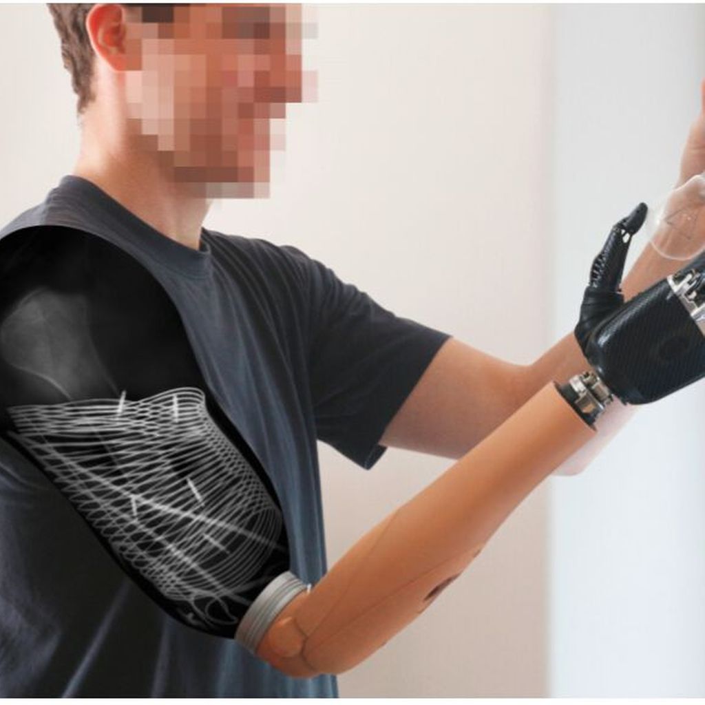 Самый дорогой протез. Бионический протез руки 2020. Современные протезы рук. Самый современный бионический протез руки. Бионические протезы рук с кожей.