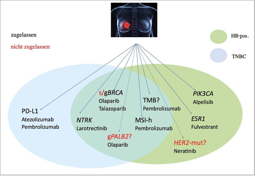 Molekulare Therapiestratifizierung Beim Mammakarzinom Onkologie Universimed Medizin Im Fokus