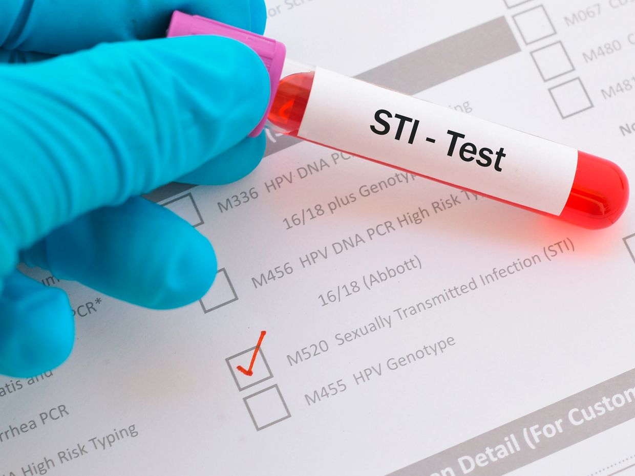 Azithromycin kaufen österreich