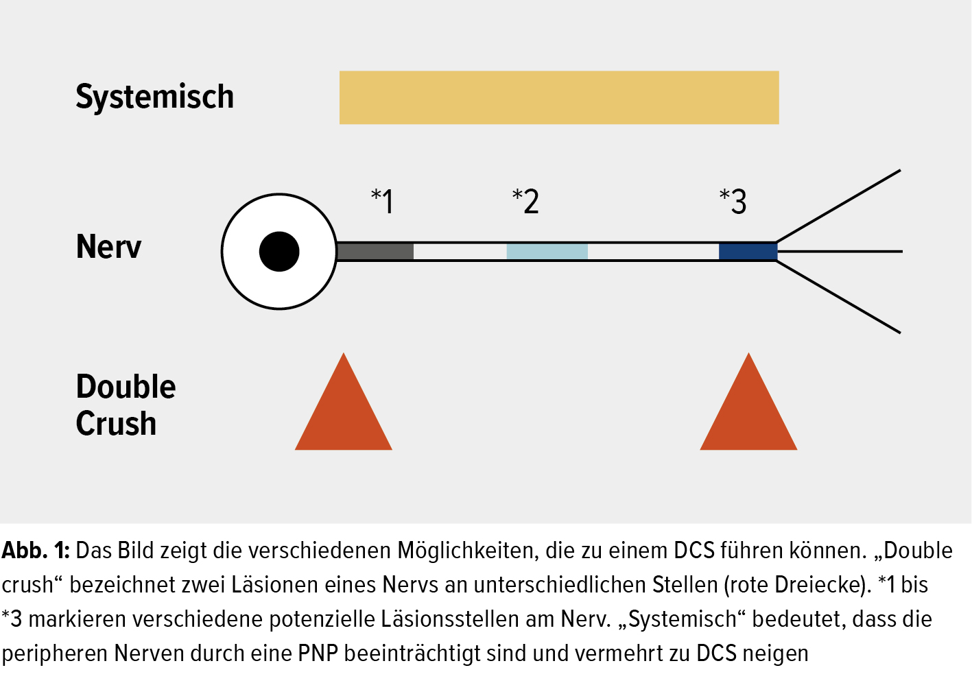 Besserung op nach ulnaris keine Probleme nach